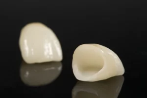 Do Veneers Protect Your Teeth crowns Do Veneers Protect Your Teeth crowns
